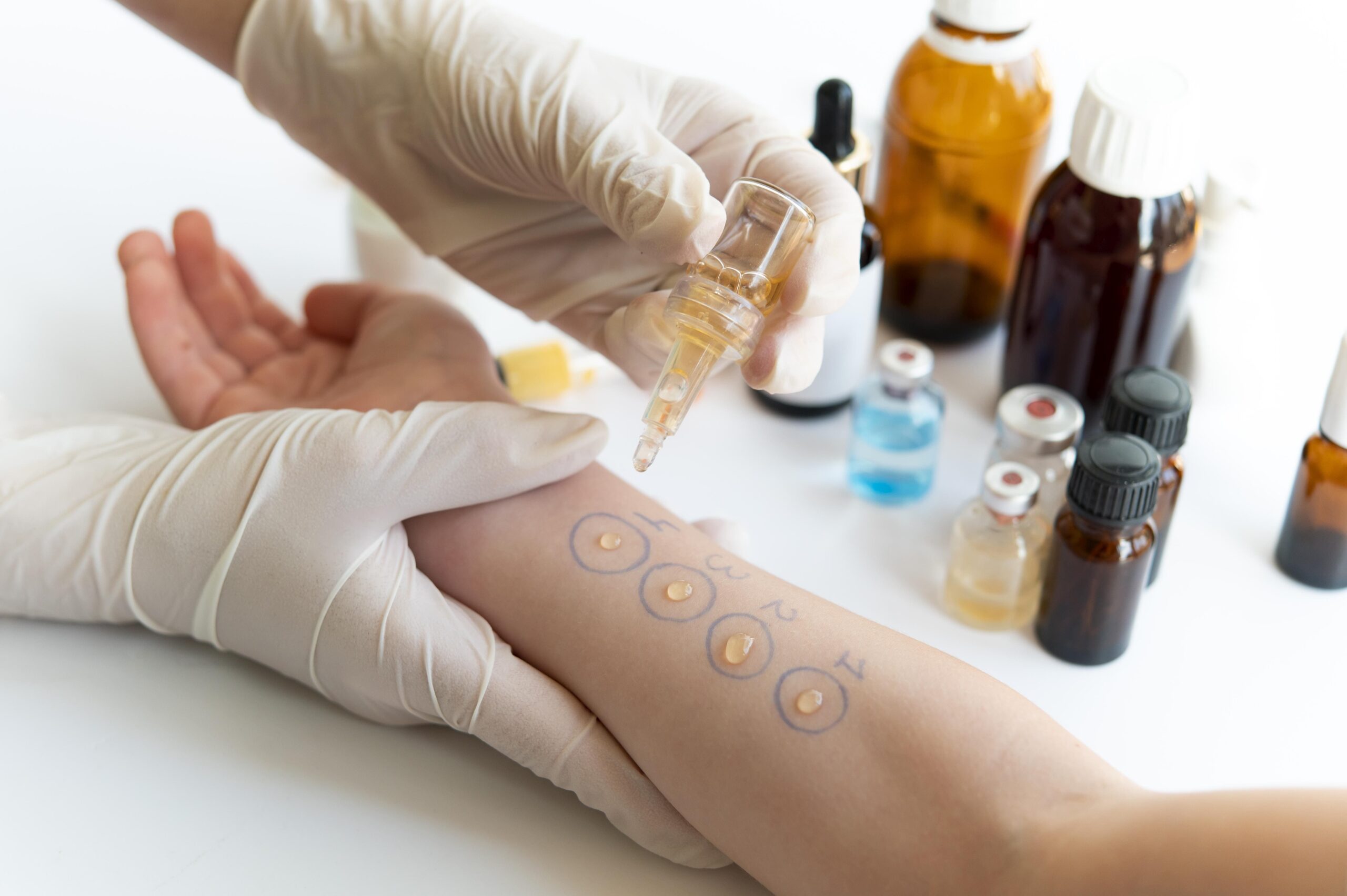 skin-allergy-reaction-test-person-s-arm (1)